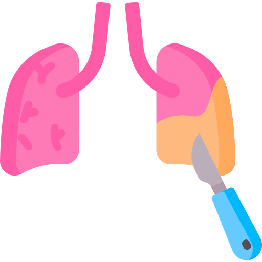Lung & Chest Surgery