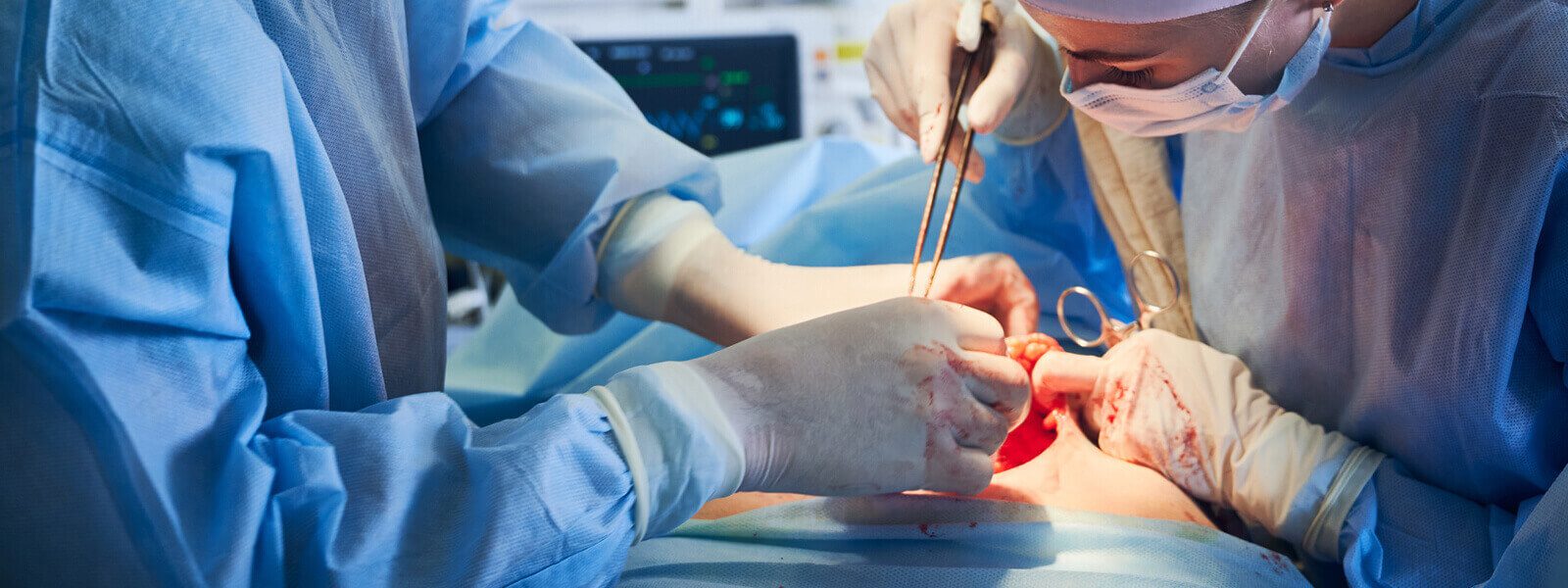 Cardiothoracic and Vascular Surgery